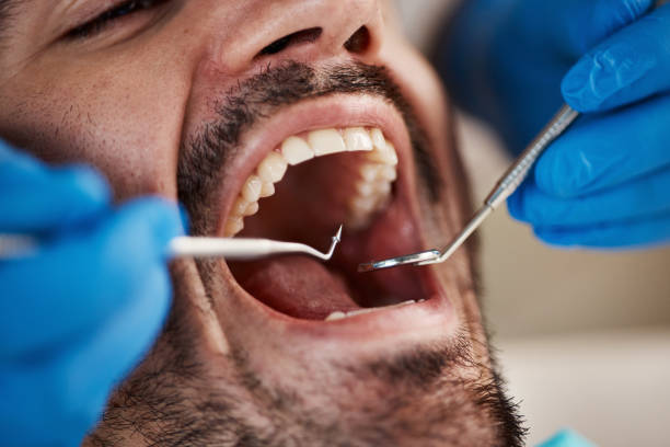 Best Emergency Dental Services for Seniors in Angier, NC